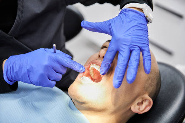 Best Walk-In Emergency Dental Services in Charter Oak, CA